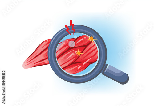 Inflamed Muscle Pain Under Magnification