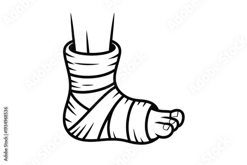 A broken ankle wrapped in a white cast illustration for medical use
