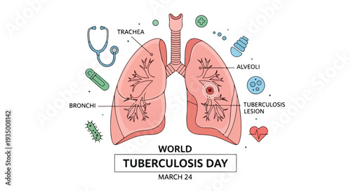 Infographic illustration of lungs with tuberculosis symptoms for World Tuberculosis Day on March 24