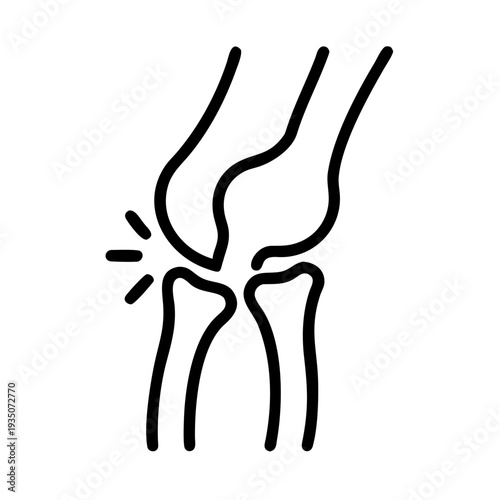 Anatomy illustration of a fractured knee joint with clear bone separation isolated on white background, Vector