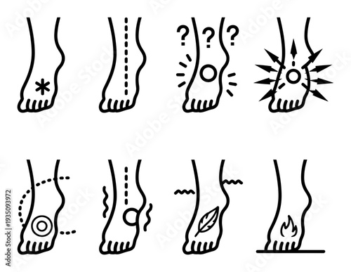 Medical Depicting Foot Pain and Sensations