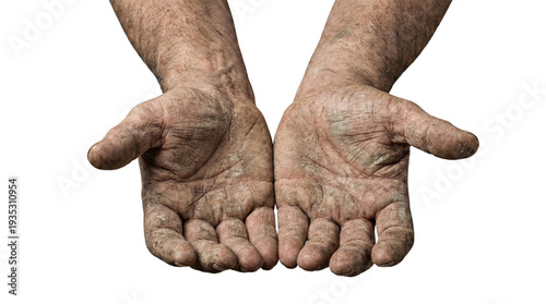 Foto Rough calloused palms of manual labor worker