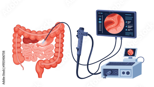 Medical illustration of human large intestine examined by endoscope with interior view displayed on digital monitors representing colonoscopy.