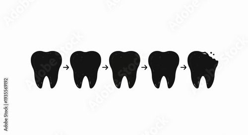 Progression of dental decay, from healthy to damaged tooth