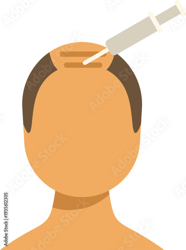 Person receiving a hair regrowth injection on a balding scalp