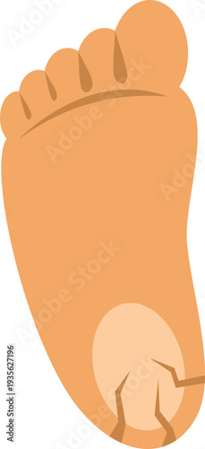 Vector illustration showing human foot sole with dry heel on white background