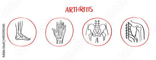 Arthritis Sketch Poster