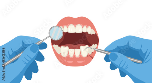 Two gloved hands holding a dental mirror and a probe are poised to examine a wide-open human mouth model with teeth on a white background.