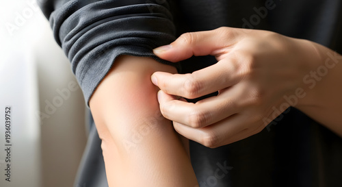 Person Scratching Arm Rash