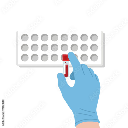 Hand in blue glove holding blood sample tube in rack for lab testing
