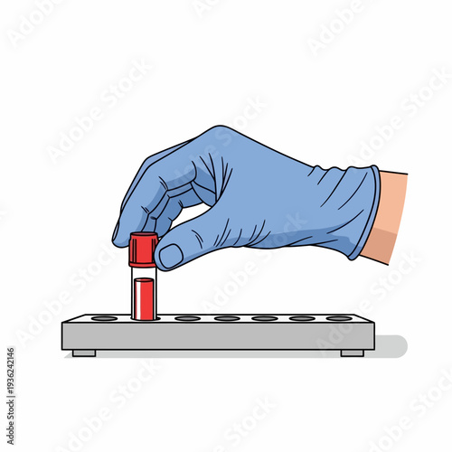 Hand in blue glove placing blood sample tube into rack for medical testing