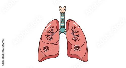 Anatomical illustration of lungs with trachea and bronchi