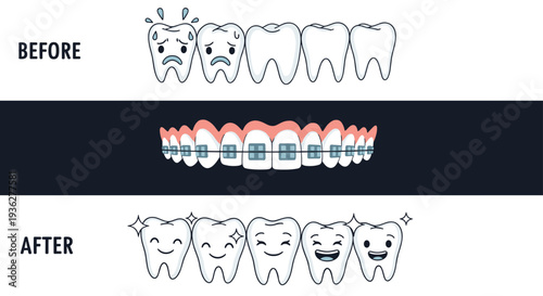 Infographic showing teeth progression from unhappy and crooked to wearing braces and becoming happy and straight.