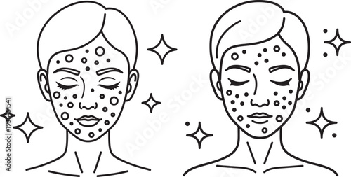 Facial Skincare Treatment and Beauty Routine Outline Icons for Acne or Spot Removal and Healthy Skin