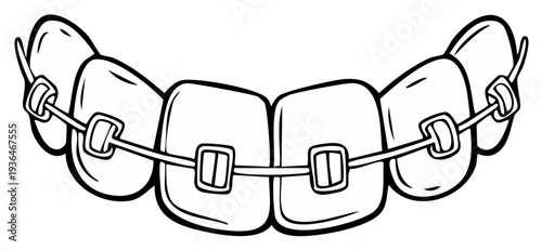 Dental Braces Illustration: Outlined Teeth with Metal Brackets and Wire for Orthodontic Treatment