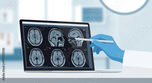 Medical professional reviewing brain MRI scans on a laptop, highlighting advanced diagnostic technology and neurological assessment in modern healthcare
