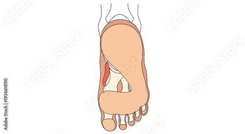 Foot with Bunion Illustration.
