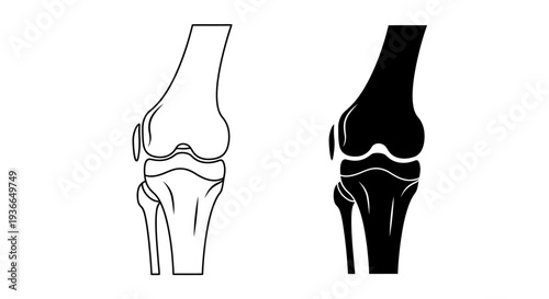 Anatomical illustration of a human knee joint in two contrasting styles