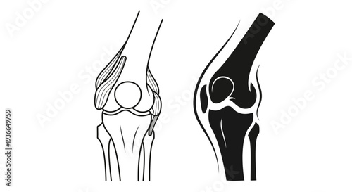Anatomical illustration of a human knee joint showing bone structure