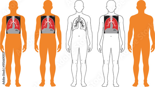 Human Body Silhouette Set with Internal Lung Anatomy and X-Ray Scans Showing Respiratory System for Medical Healthcare and Education