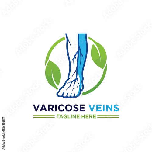Vector illustration of a human leg with highlighted veins, symbolizing natural health and circulatory well-being.