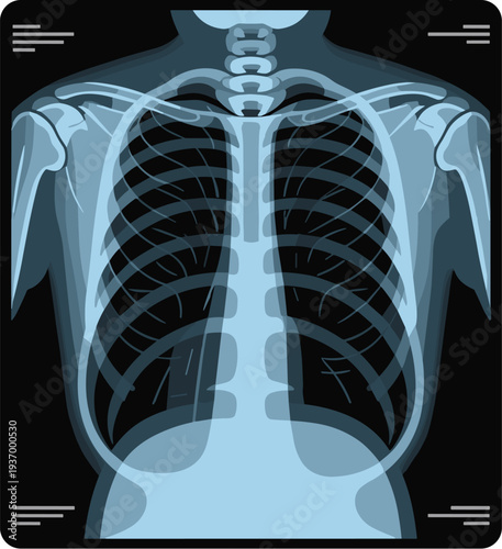 Detailed human chest x ray showing ribcage and spine for medical diagnosis concept