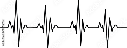 An electrocardiogram reading on a white background showing a normal heart rhythm pattern