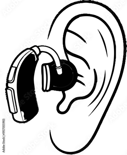 Black and white illustration of a hearing aid fitted in a human ear