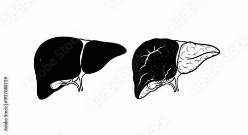Two contrasting anatomical liver illustrations, one solid black, one detailed