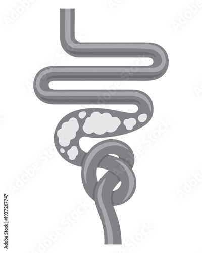 Digestive System Diagram