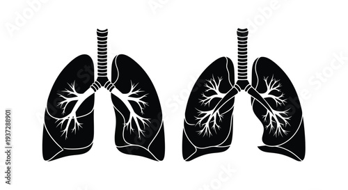 Anatomical illustration of human lungs showcasing bronchial branching