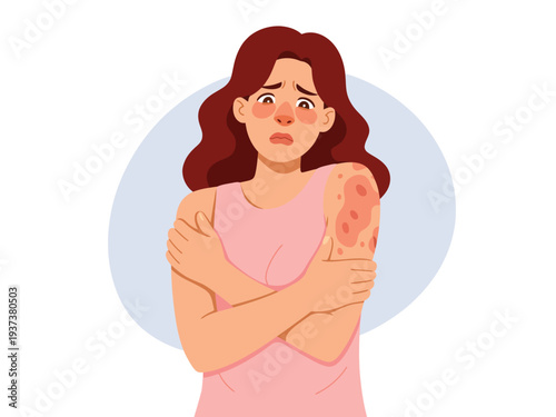 Woman with red skin rash on shoulder, worried expression, pink dress, long brown hair