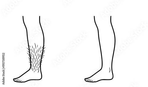 A vector graphic illustration of two human legs comparing hairy and smooth shaving
