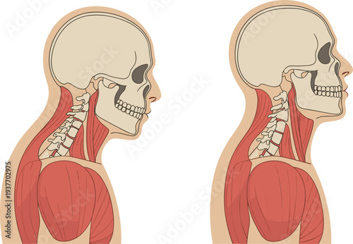 Human neck posture comparison illustration showing forward head posture and correct alignment with skull spine and muscles anatomical diagram for medical education ergonomics and health awareness