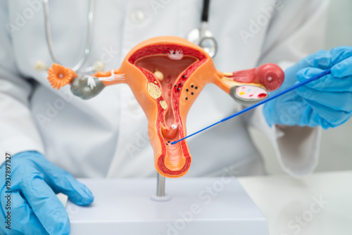 Фотография Doctor holding human uterus model for vaginal and cervix pap smear check up in the obstetrics and gynecology
