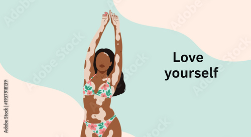 Beautiful woman with vitiligo skin condition wears a floral bikini and embraces body positivity alongside love yourself typography text.