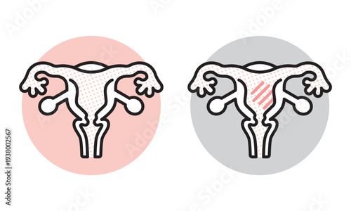 シンプル　イラスト　子宮の健康状態の比較イメージ 女性の健康 ベクターイラスト