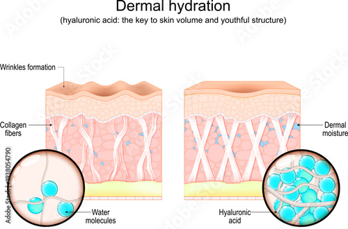 Human skin. Hyaluronic acid, Dermal moisture and Wrinkles formation