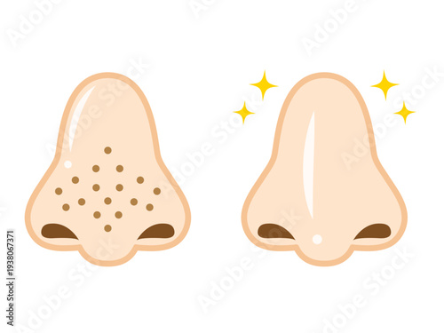 毛穴汚れが目立つ鼻のイラスト素材