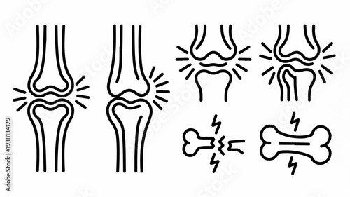Knee pain and bone injury illustrations joint inflammation and bone fracture symbols