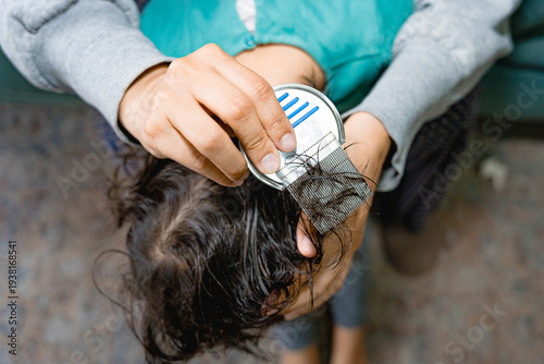 Photos closeup of lice and nits removal with lice comb on baby girl head hair by hand