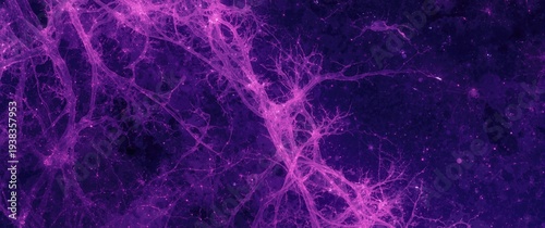 Brain tumor histology showing meningiomaâ€™s signature whorl cellular pattern