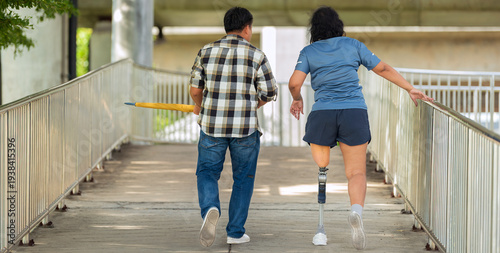 Schilderij op canvas Loving couple walking together on outdoors walkway woman with prosthetic leg and her supportive partner