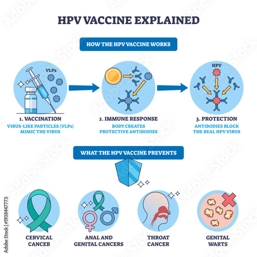 HPV vaccine explained, step-by-step of immunization, immune response, and protection, syringe, antibodies, virus icons show prevention of cancers and warts, transparent background.