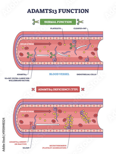 ADAMTS13 function, enzyme cleaves vWF in a blood vessel to limit platelet clumps, deficiency leads to TTP microthrombi, transparent background.Key objects, platelets, vWF, vessel.