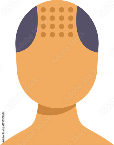 Man's scalp showing follicle implantation site for hair restoration