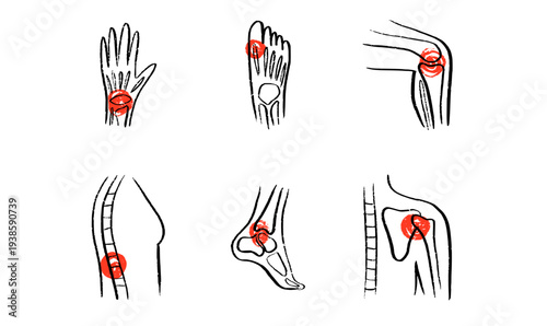 Arthritis Sketch Poster