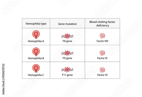 Hemophilia, a bleeding disorder that slows the blood clotting. Haemophilia types A,B,C Coagulation disorder. Gene mutations, Blood clotting factors deficiency VIII, IX, XI. Vector illustration.