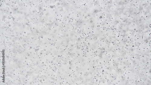 Dense microscopic sperm field showing active motility, research scientist conducting CASA tracking for fertility study numerous motile spermatozoa across slide under clinical lighting.