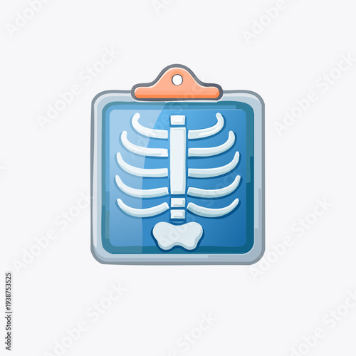 Medical X-ray image of human rib cage on clipboard.